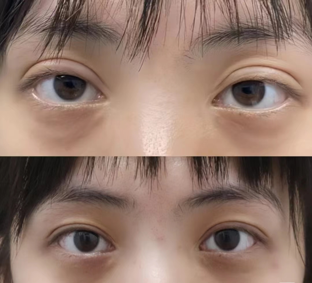 上海做眼修復最有名的醫生是哪個