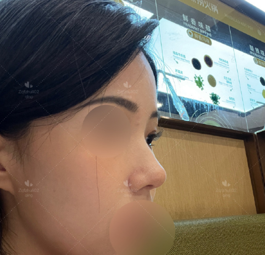 國內鼻修復最好的醫生是哪個