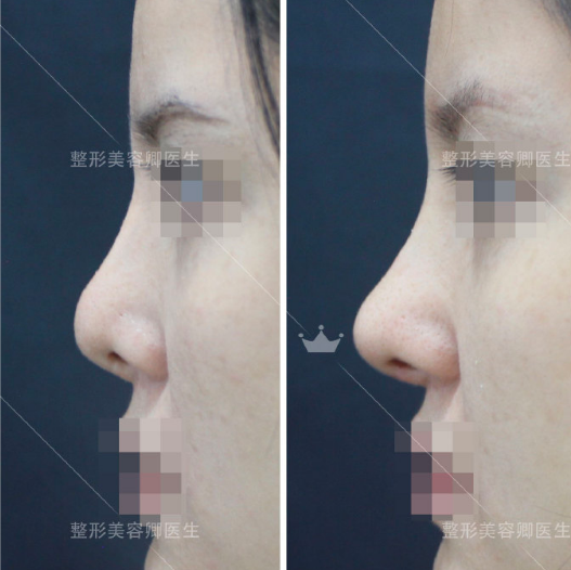 卿勇鼻綜合案例
