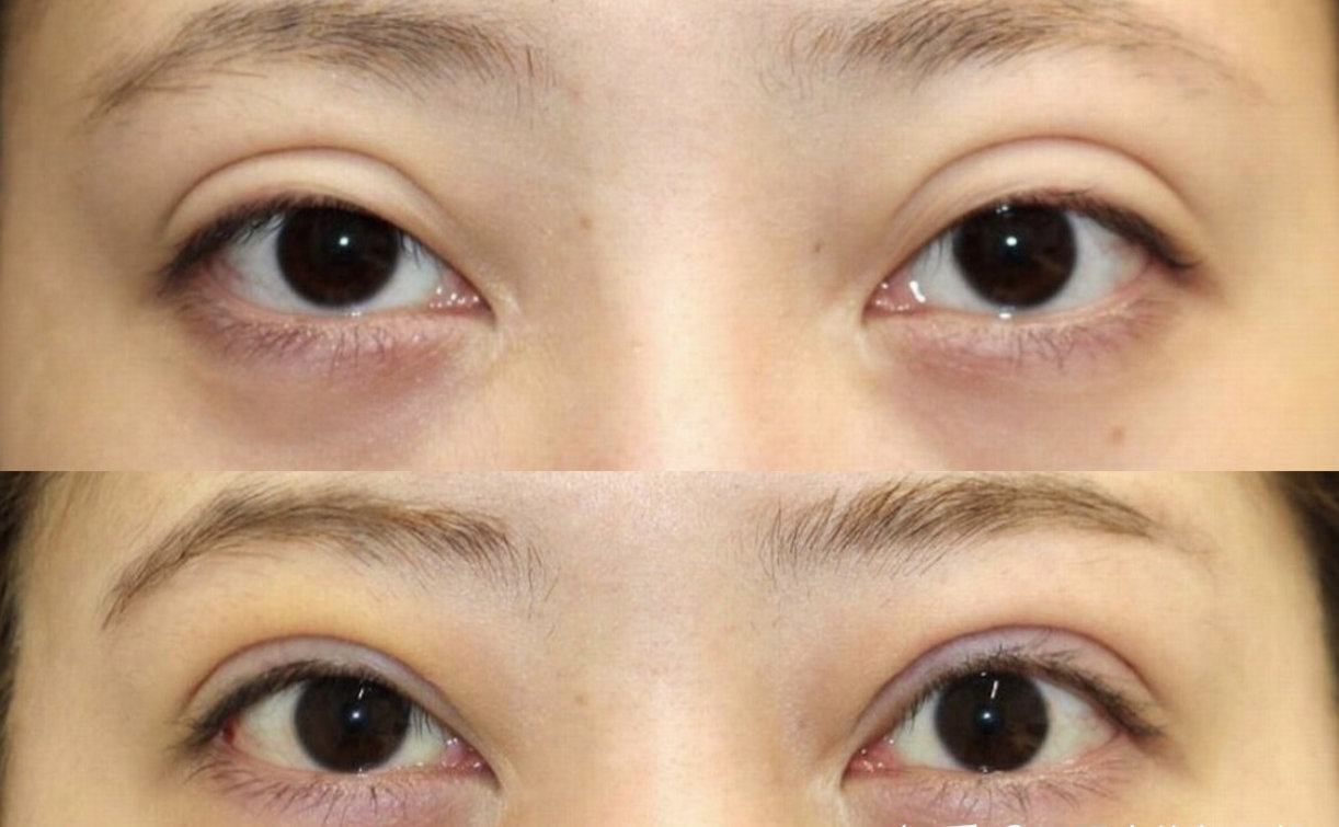 上海眼修復最好的醫生排名前十