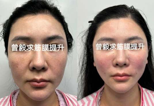 曾毅求醫(yī)生